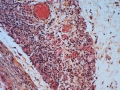 angiogénèse 04 V07-283