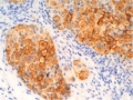 Oncology