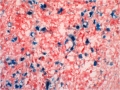 Oncology