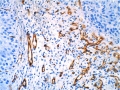 Oncology