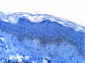 dermato (5)